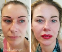 /album/fotogalerie/rty-2022-jpg16-jpg/